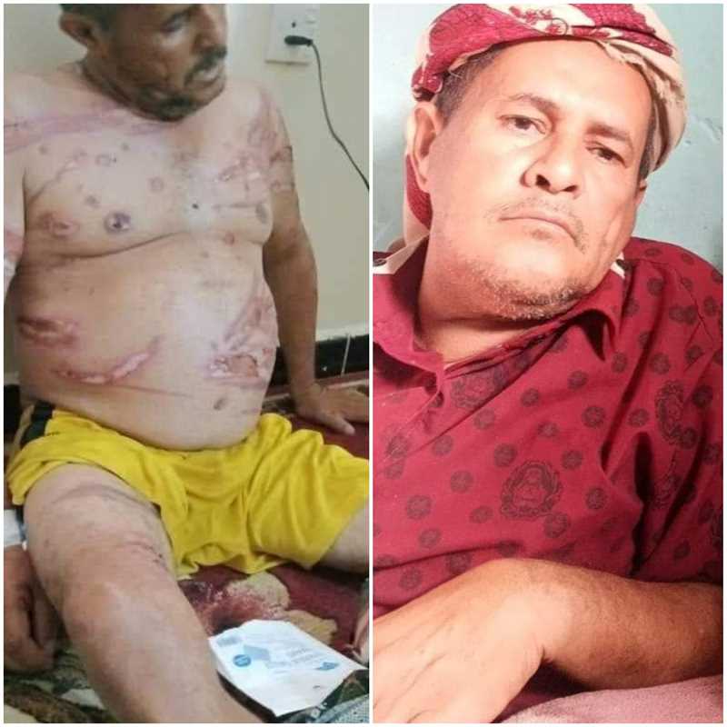 "مركز حقوقي" يدعو للتحقيق في وفاة مختطف من إب تحت التعذيب في سجون الانتقالي