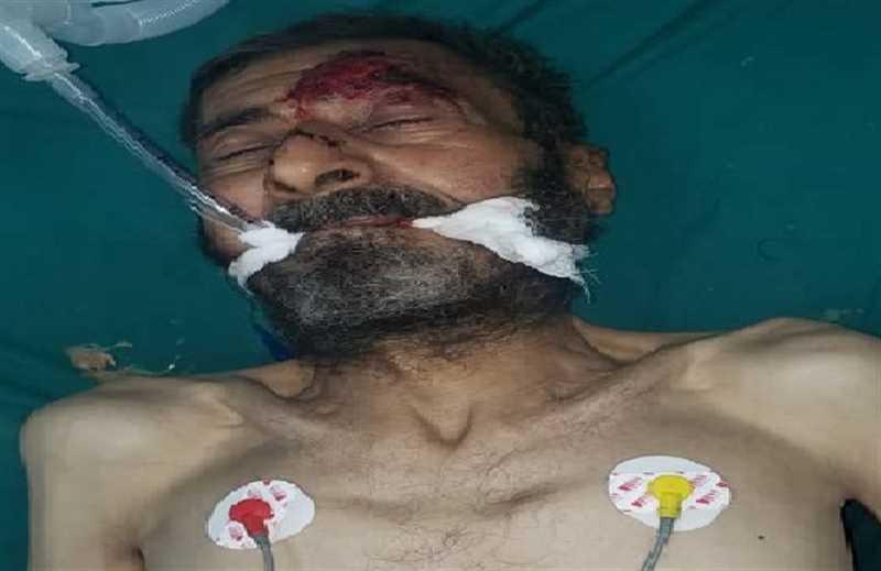 وفاة مواطن من إب في حادثة دهس بصنعاء