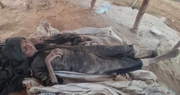 حجة.. وفاة مُسنة نازحة جراء الجوع والمرض في مخيم للنزوح بعبس