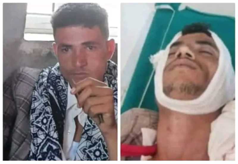 مقتل شاب بنيران مليشيا الحوثي شمالي تعز