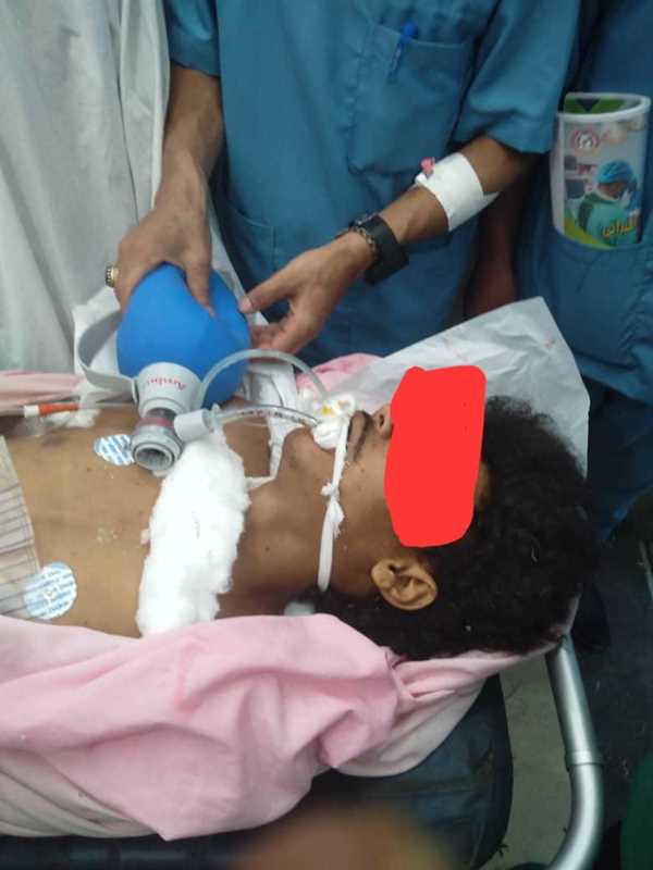 تقرير: مقتل وإصابة 1022 مدنياً بالألغام الحوثية خلال عام التهدئة