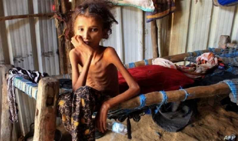 الأمم المتحدة: اليمن يعاني من أكبر الأزمات الإنسانية في العالم
