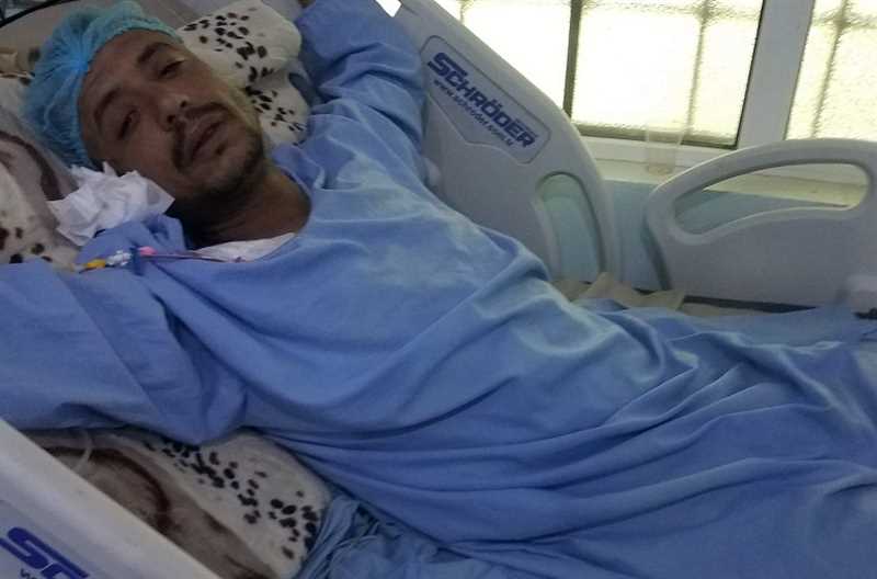 إصابة شاب بجروح خطيرة جراء انفجار طفاية حريق بإب