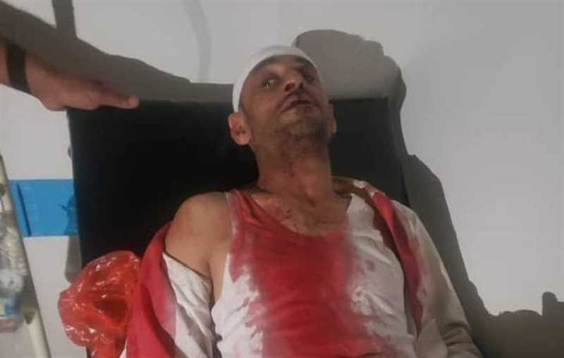 يتزعمها عنصر حوثي.. عصابة تبرح مواطن ضرباً في مدينة إب القديمة