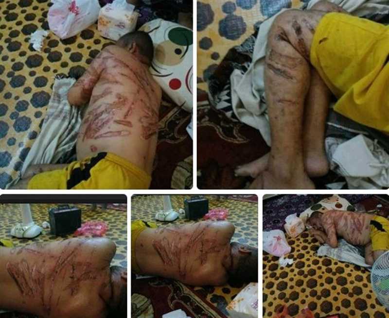 منظمة حقوقية: احتجاز وتعذيب المُسن "العديني" جريمة ضد الإنسانية تستوجب العقاب