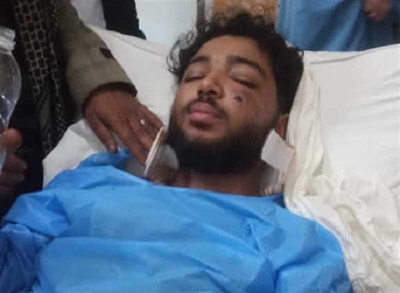 إب..إصابة شاب بطلق ناري وهو في انتظار دوره بمحطة وقود