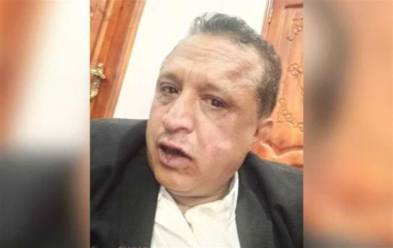 صنعاء..صحفي يمني يتلقى أوامر (حوثية) بعدم الكتابة في الشأن المحلي