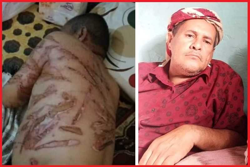 منظمة حقوقية تدعو إلى تسريع محاكمة المتهمين باحتجاز وتعذيب المُسن "محمد حسن مهدي" 